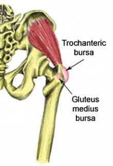 dureri ale articulațiilor extremităților superioare boală articulară purulentă