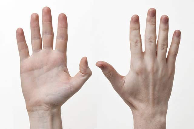 Fingerledbetændelse | årsag og behandling