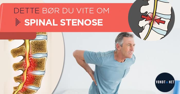 Spinal Stenose Trening